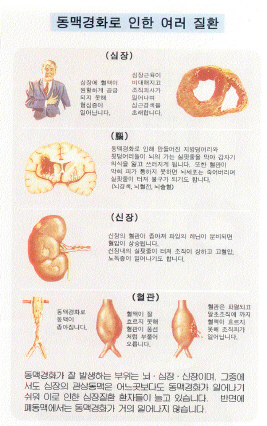 내부의 적 지방간,콜레스테롤 2